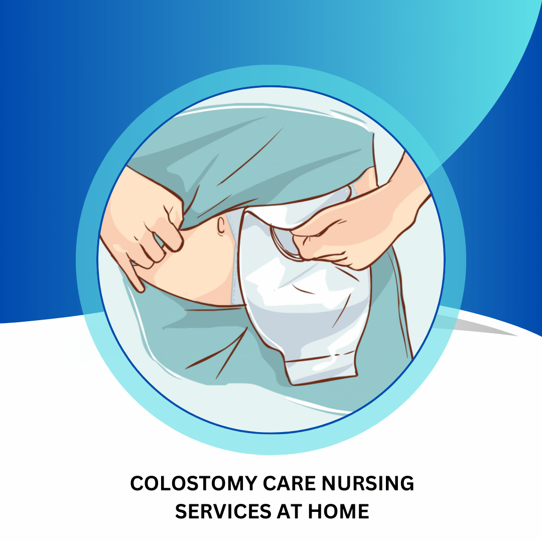Colostomy Care Nursing Services