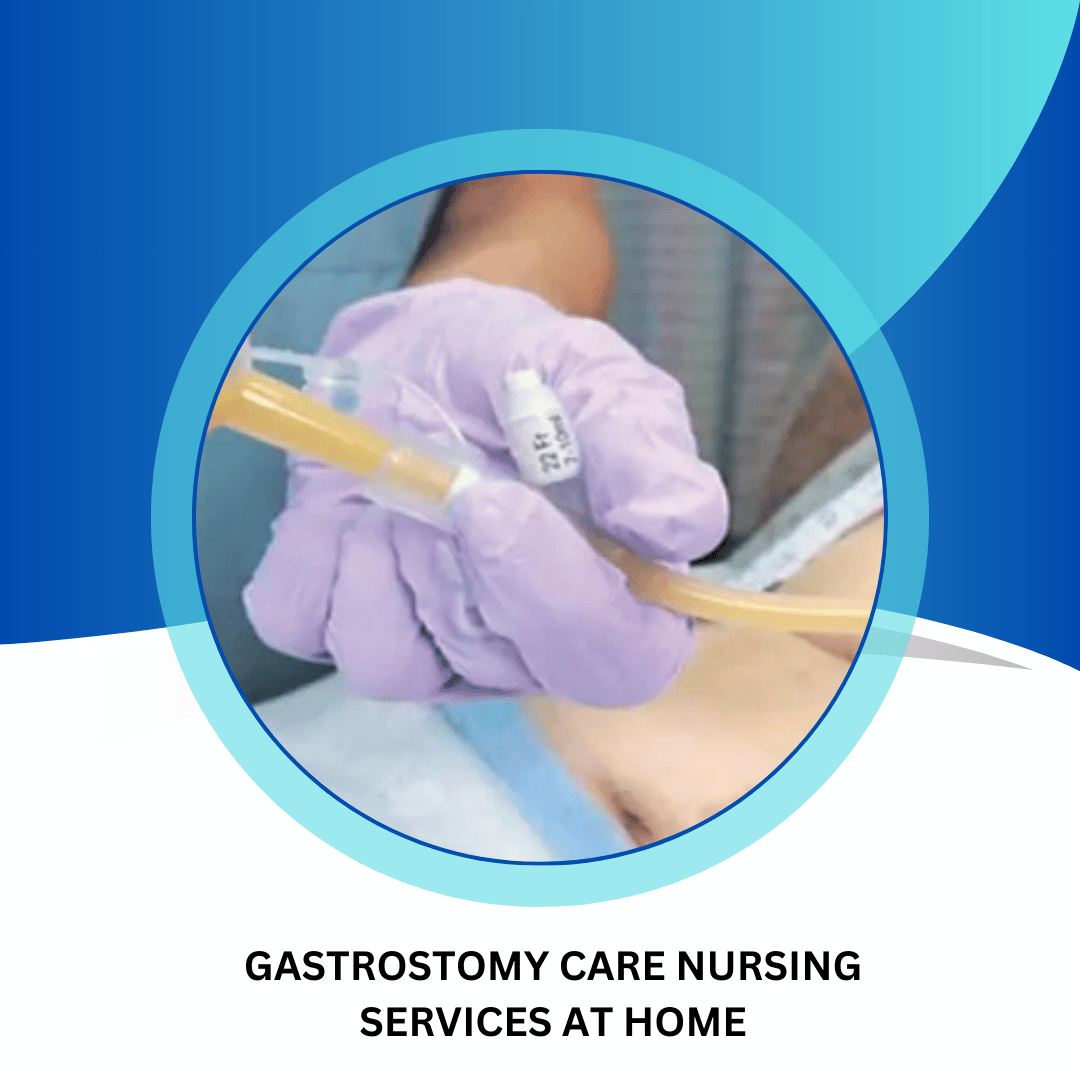 Gastrostomy Care Nursing Services