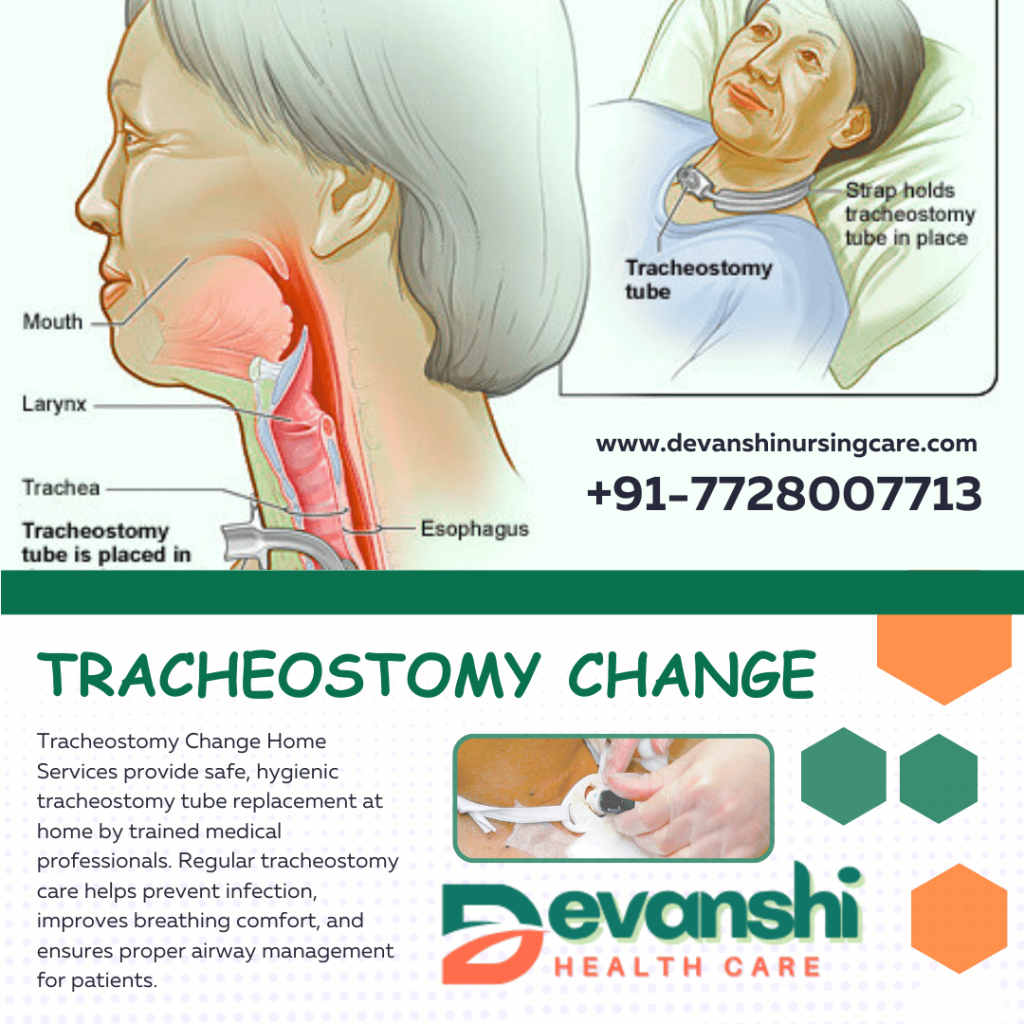Tracheostomy Change at Home in Sector 11 Vasundhara, Ghaziabad