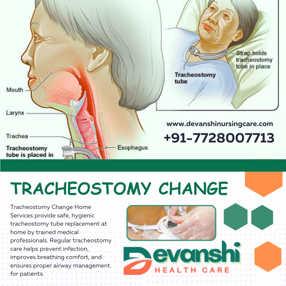 Tracheostomy Change at Home in Sector 11 Vasundhara, Ghaziabad